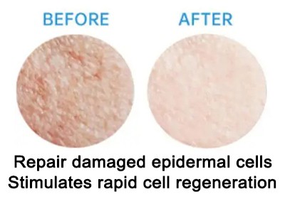 nine peptides powder Repairs Skin